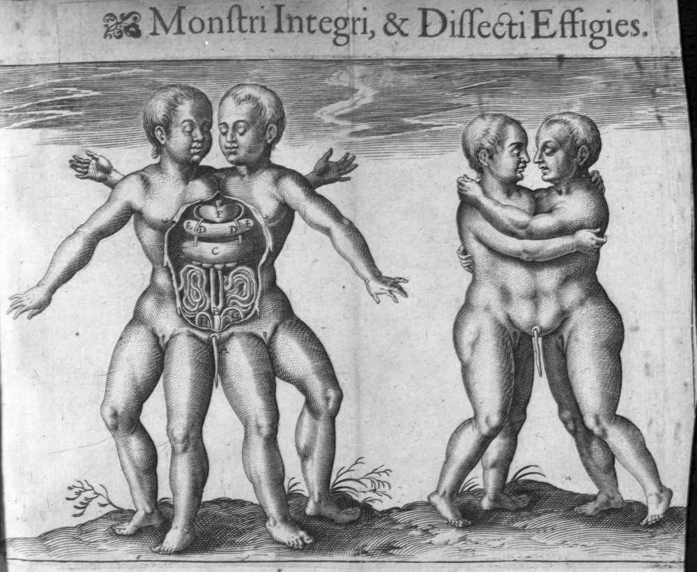 De monstro nato Lutetiae, 1605